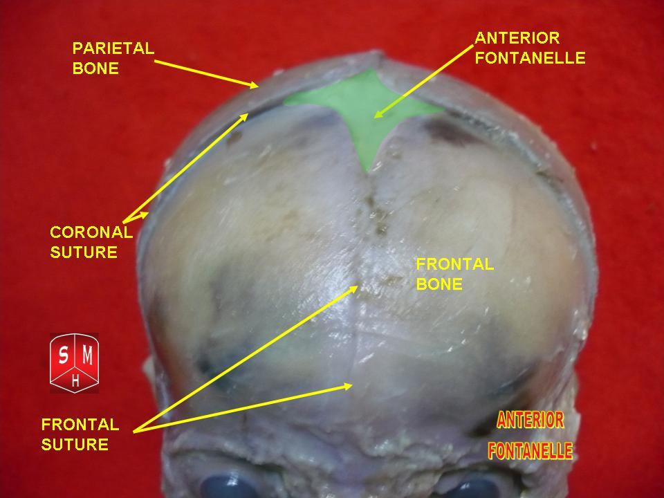 Fontanelle